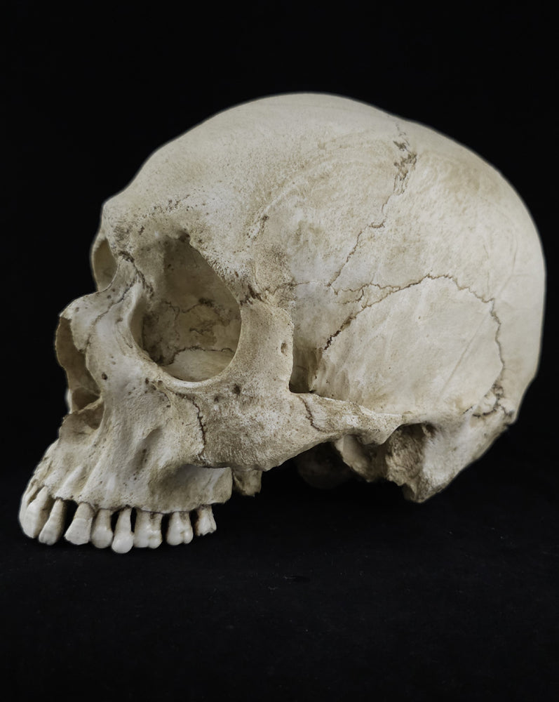 
                  
                    RH-A skull no lower jaw
                  
                