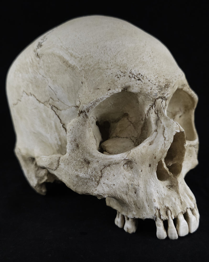 
                  
                    RH-A skull no lower jaw
                  
                