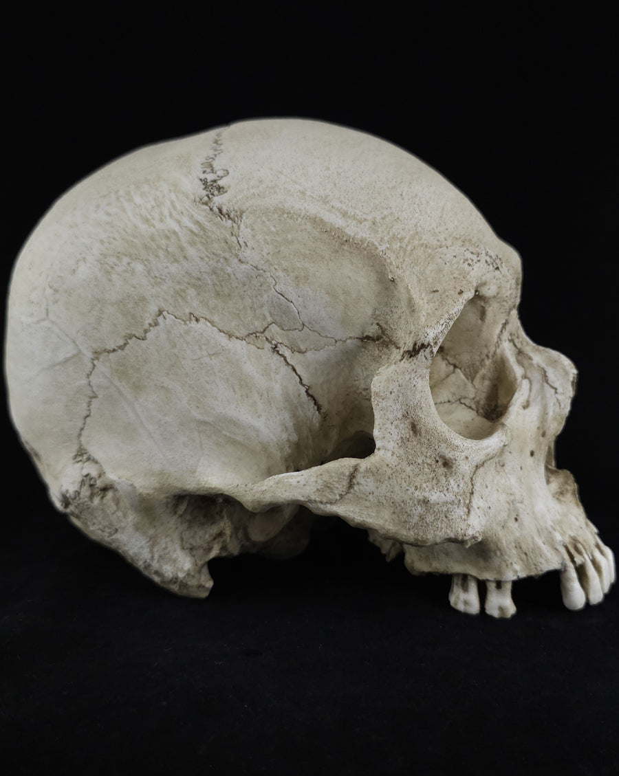 
                  
                    RH-A skull no lower jaw
                  
                