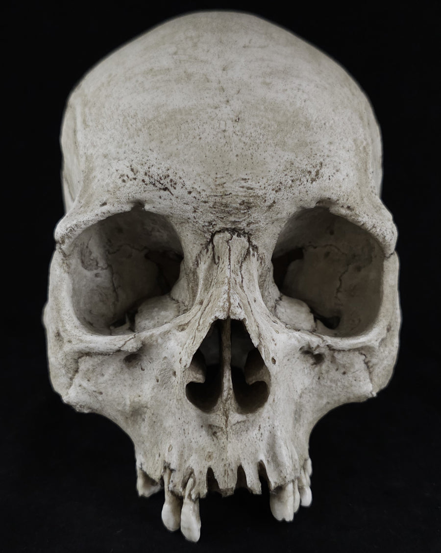 RH-B skull model no lower jaw