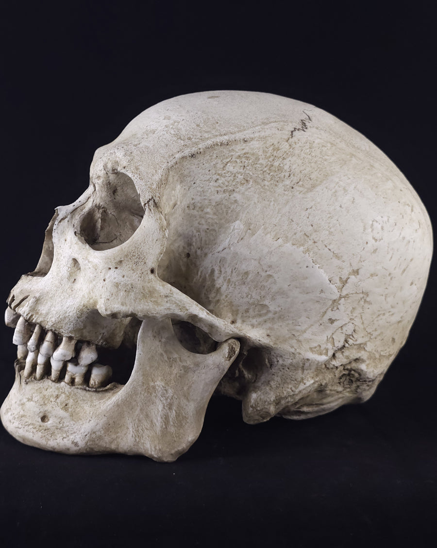 
                  
                    Graveyard RM Model
                  
                