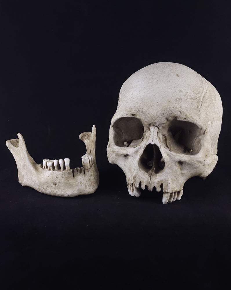 
                  
                    Graveyard RM Model
                  
                