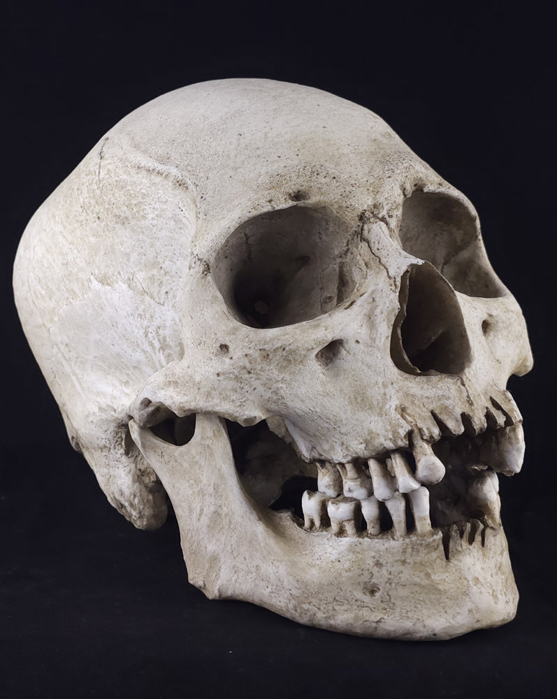 
                  
                    Graveyard RM Model
                  
                