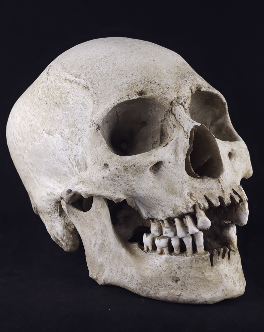 
                  
                    Graveyard RM Model
                  
                
