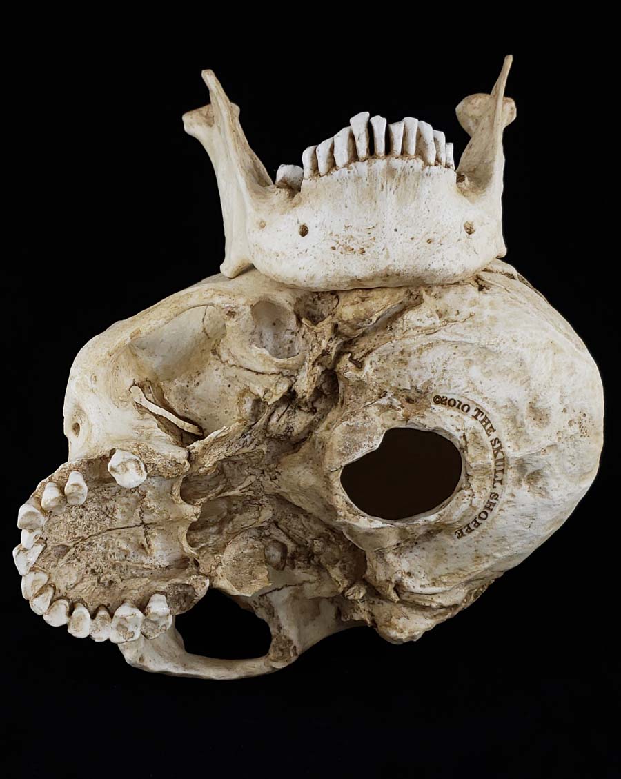 
                  
                    MM Skull Model
                  
                