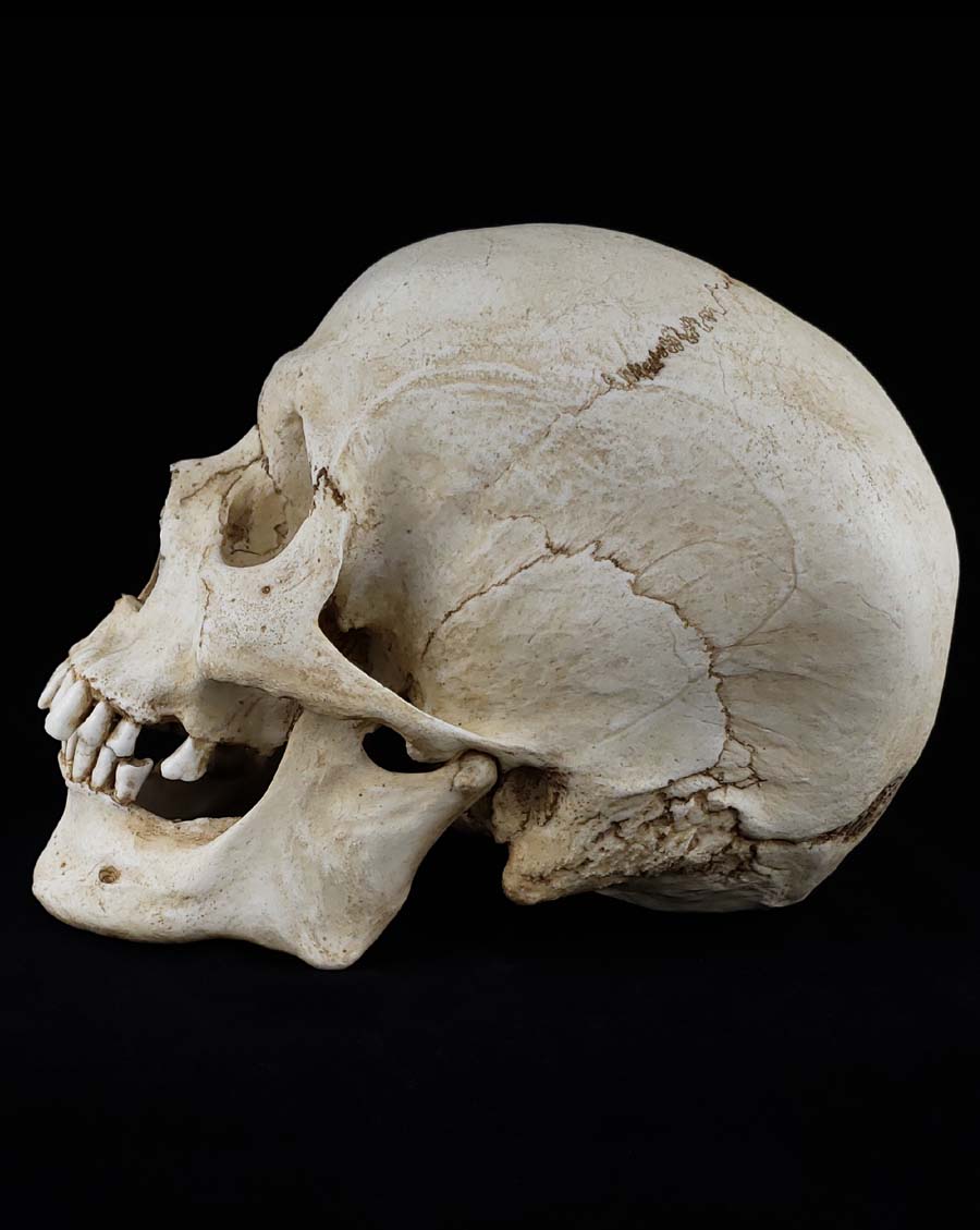 
                  
                    MM Skull Model
                  
                