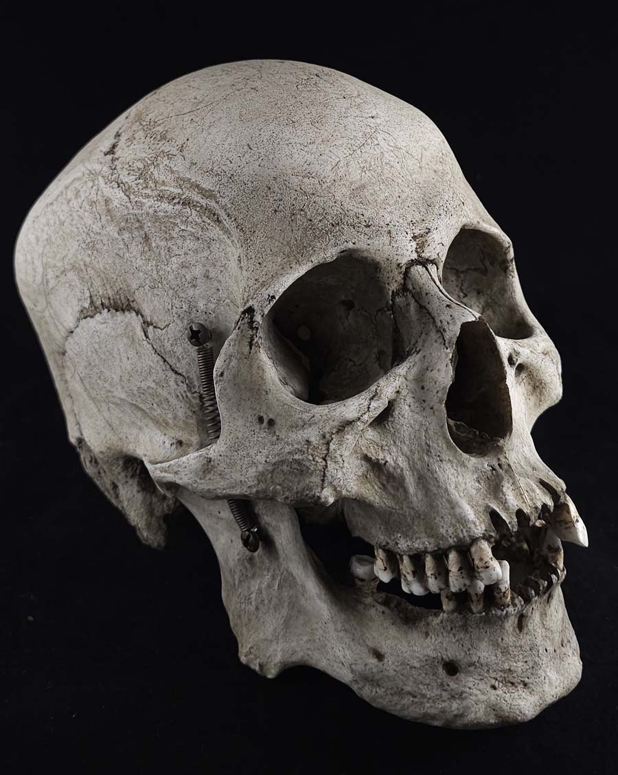 
                  
                    MM Graveyard Model
                  
                