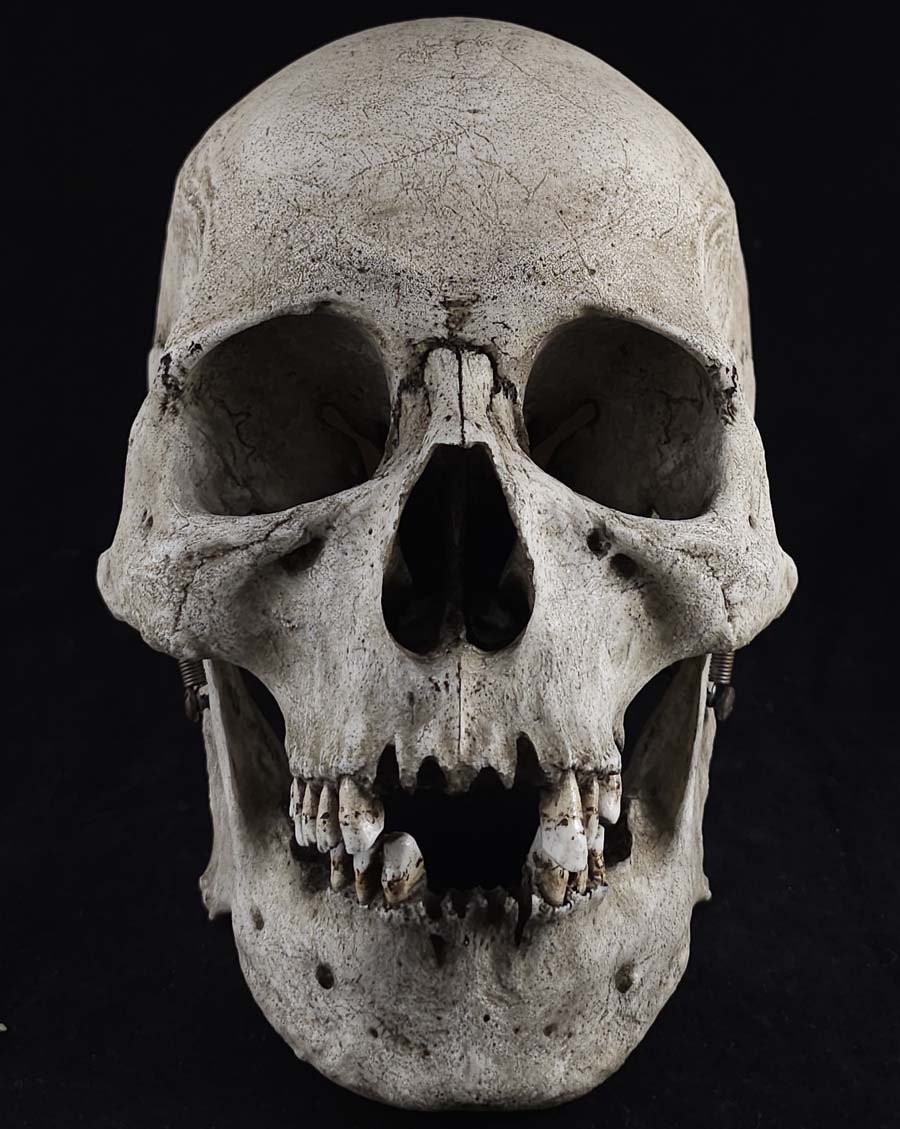 
                  
                    MM Graveyard Model
                  
                