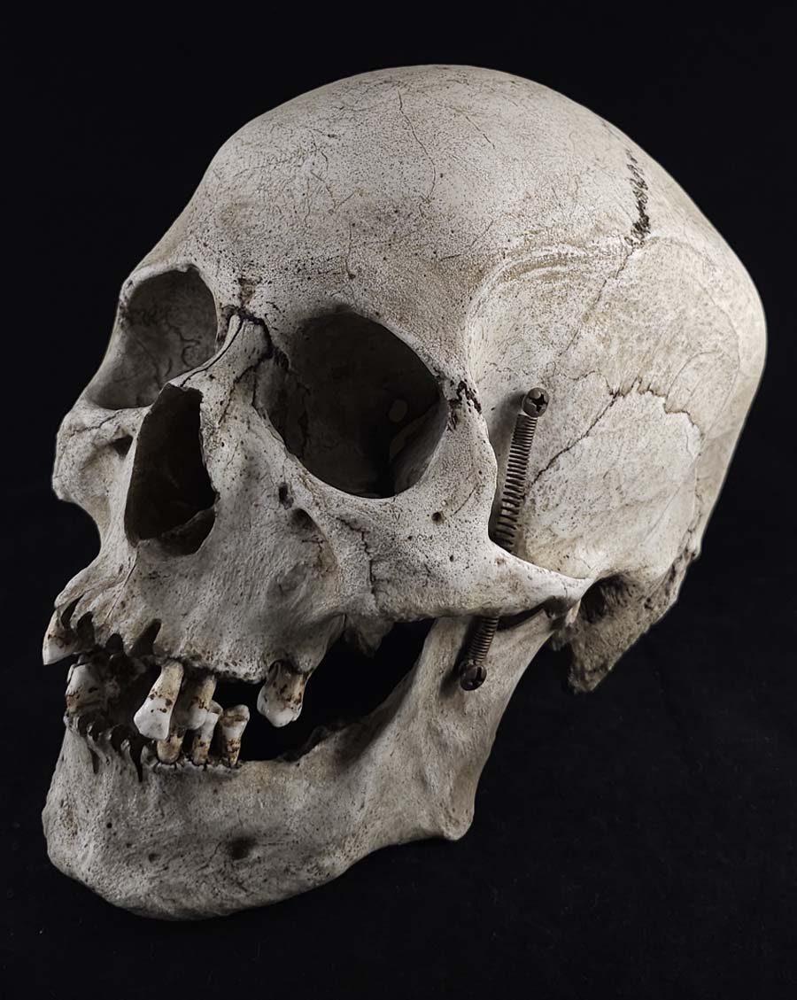 
                  
                    MM Graveyard Model
                  
                