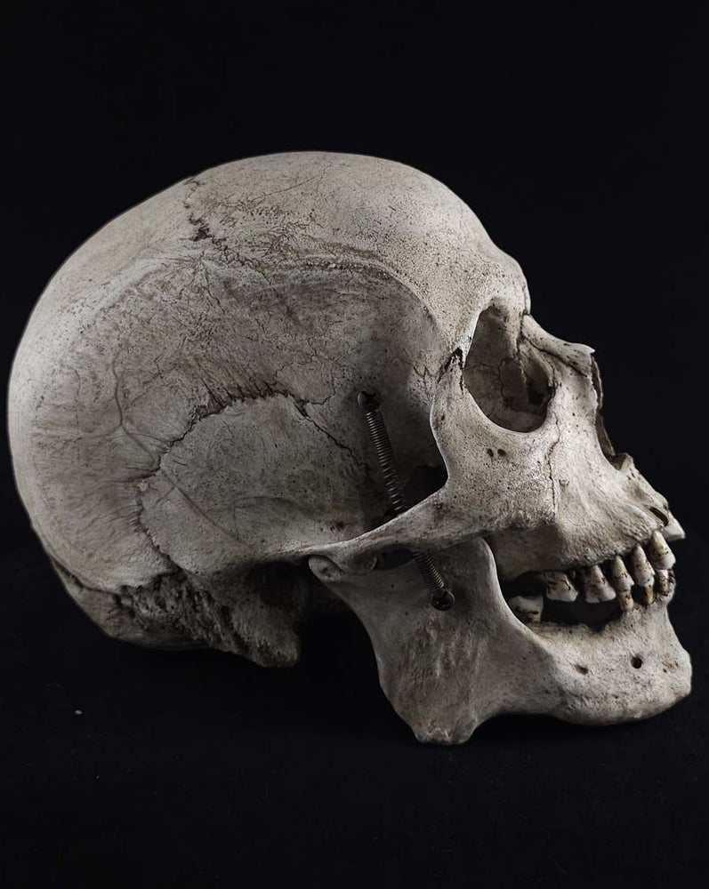 
                  
                    MM Graveyard Model
                  
                