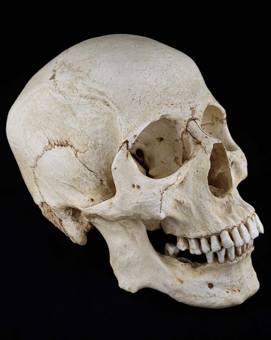 
                  
                    MM Skull Model
                  
                