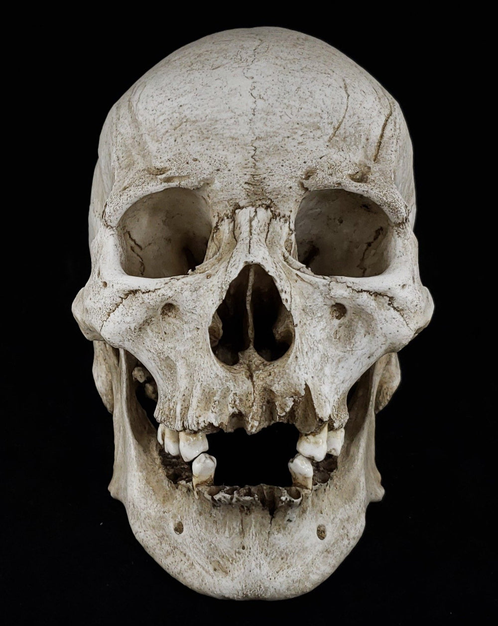 Human skull replica with natural bone color facing front.